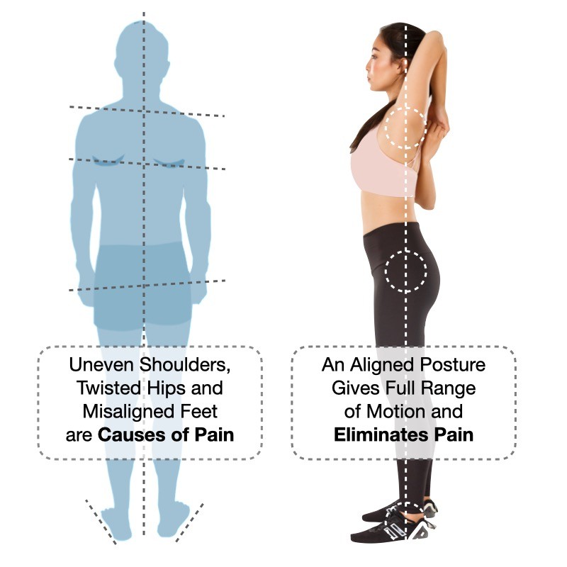 {Keyword 1:20} posture alignment therapy